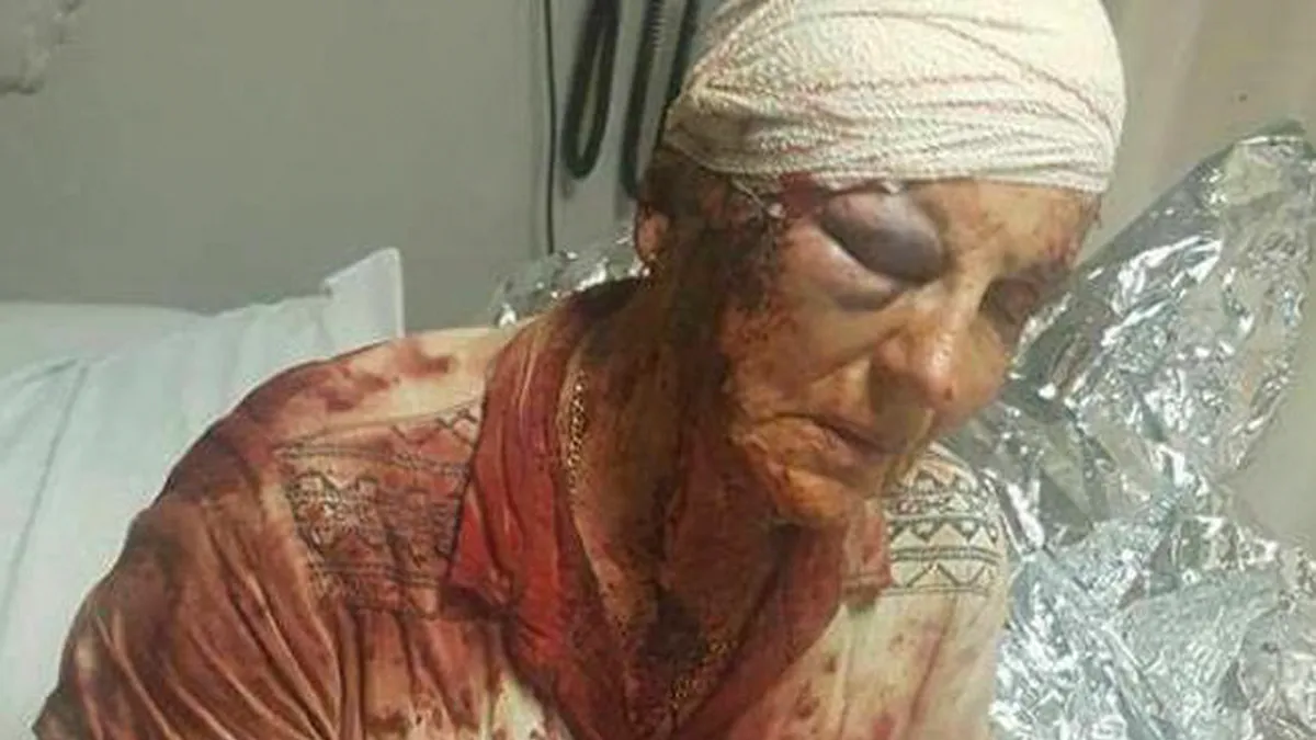 ABC’s Fake News Attack on SA Refugees