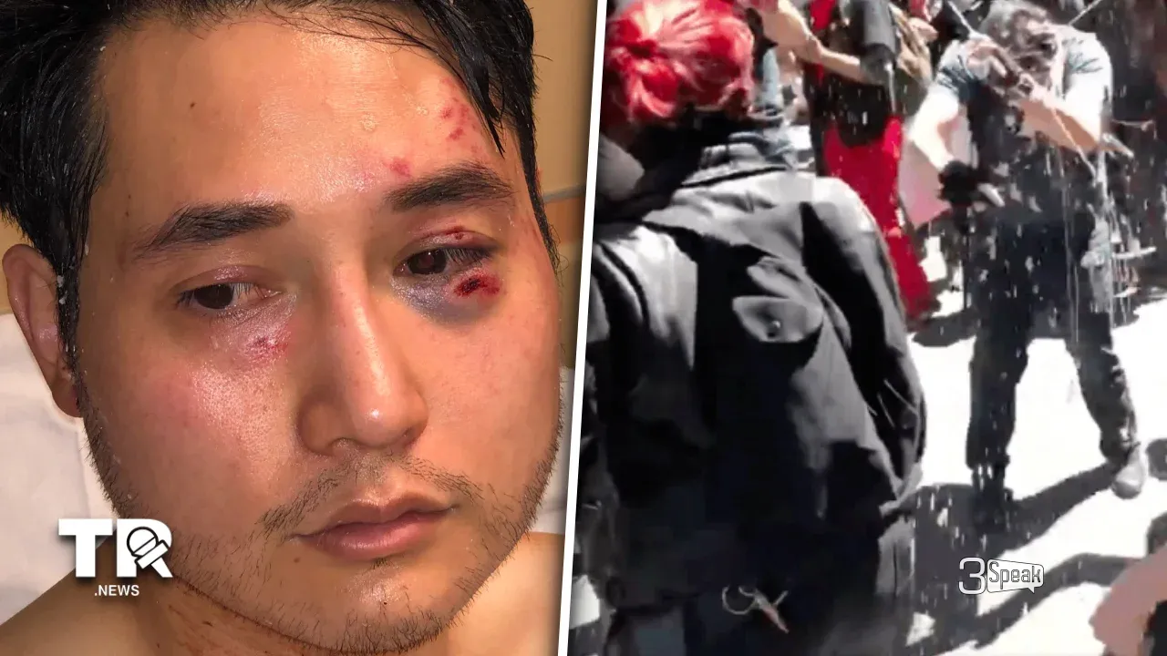 Surprise, Surprise: The UN  Backs Antifa Thugs