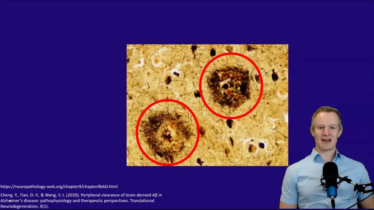 Treating Dementia with Diet: Evidence-Based Prevention and Management