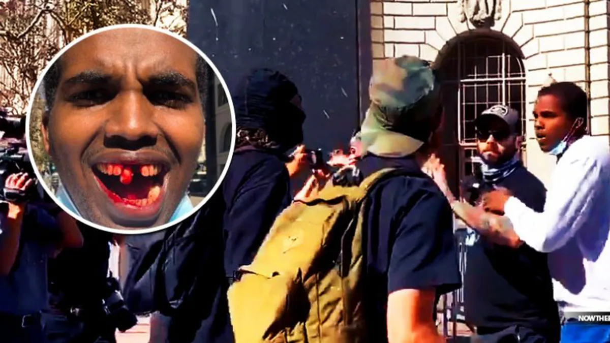 The “Anti-racists” Who like Punching Black Folks