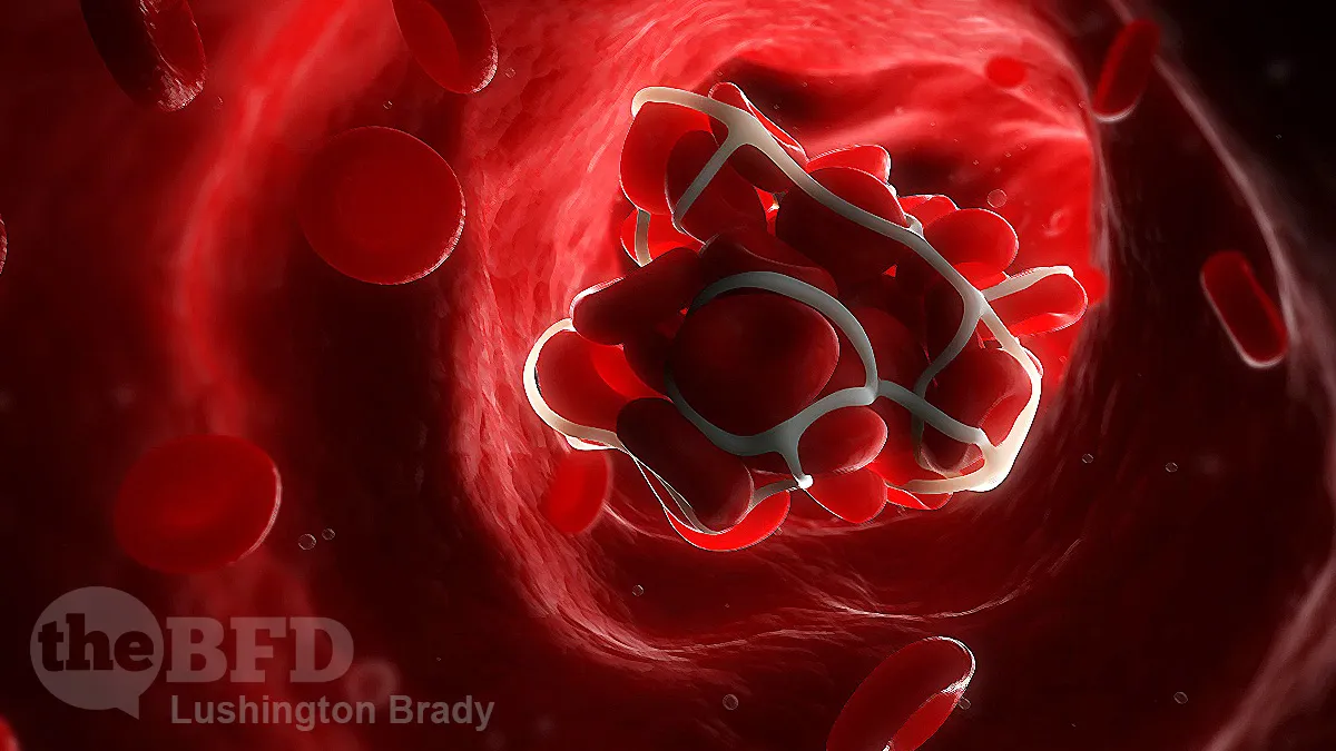 So It Is the Clot Shot