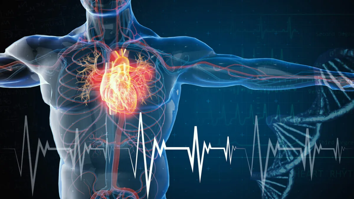 Sudden Cardiac Death Among Athletes