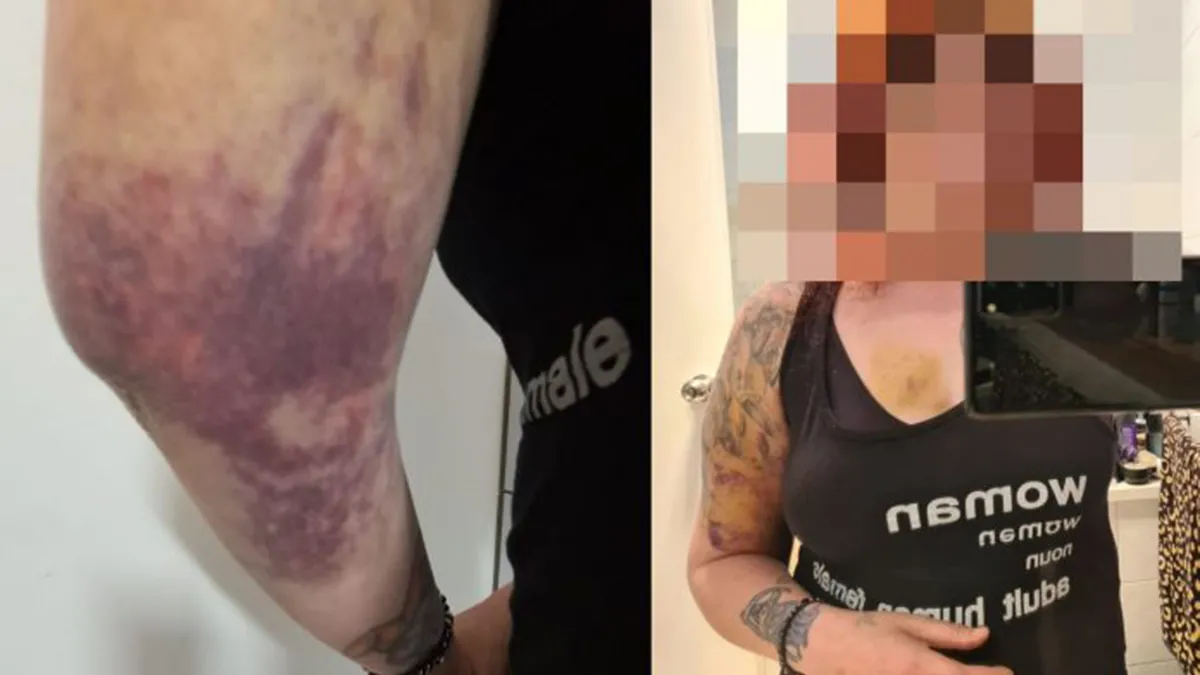 Thing That Never Happens, Happens #23