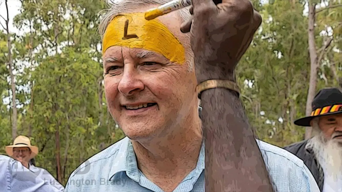 Albo Has United Australians at Last